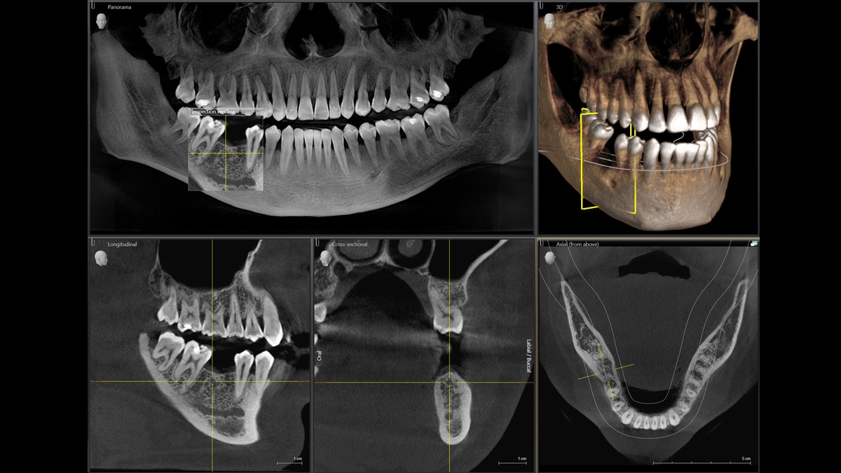 Green Apple Dental Care Orthophos S 3D xray image