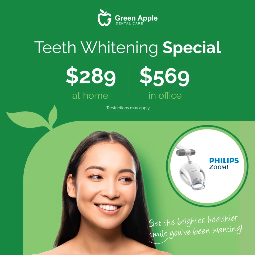 Green Apple Dental Care Teeth Whitening Offer